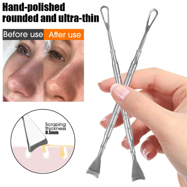 Blackhead Remover Tool – Acne & Pimple Extraction Kit - Image 3