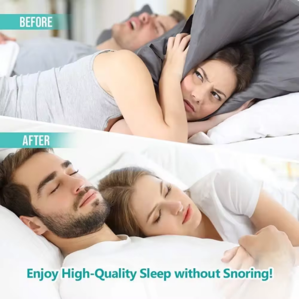 Anti-Snoring Nose Clip – Stop Snoring & Improve Sleep - Image 2