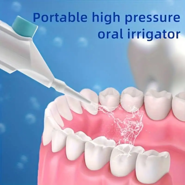 High-Pressure Oral Irrigator – Deep Clean for Teeth & Gums - Image 2