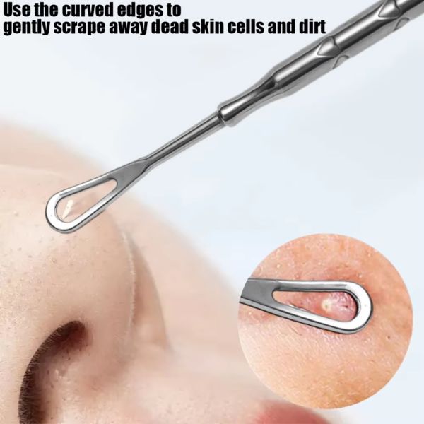 Blackhead Remover Tool – Acne & Pimple Extraction Kit - Image 2