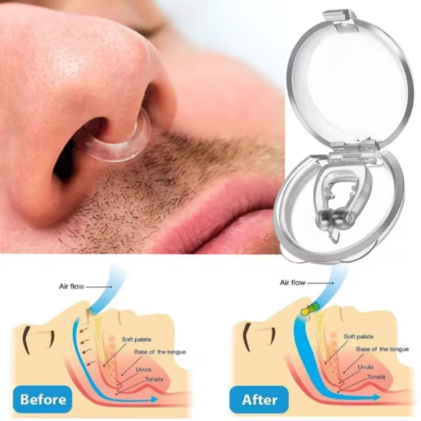 Anti-Snoring Nose Clip – Stop Snoring & Improve Sleep - Image 4